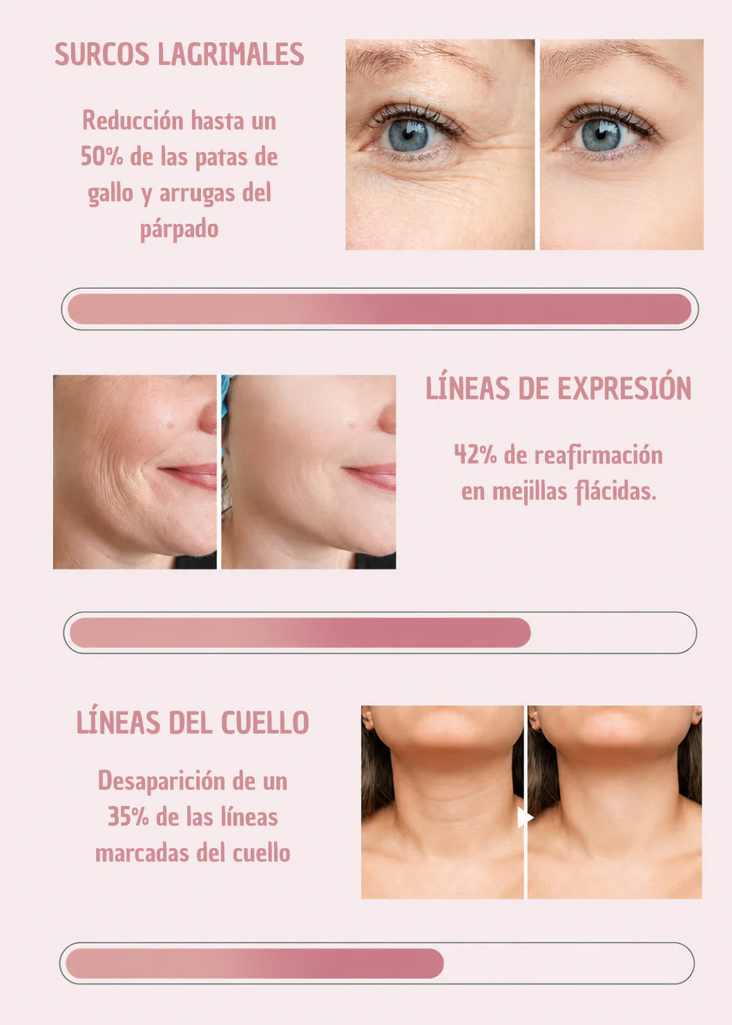COMPRA 1 LLEVA 3 por 29.99€- Bálsamo antiarrugas VITALIS